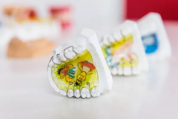 Bunte Kinderzahnspange mit Comicmotiv auf einem Gipsmodell beim Kieferorthopäden.