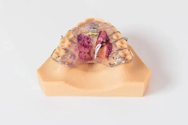 Modell eines Oberkiefers mit bunter Zahnspange und Schmetterlingsmotiv zur Kieferorthopädie.